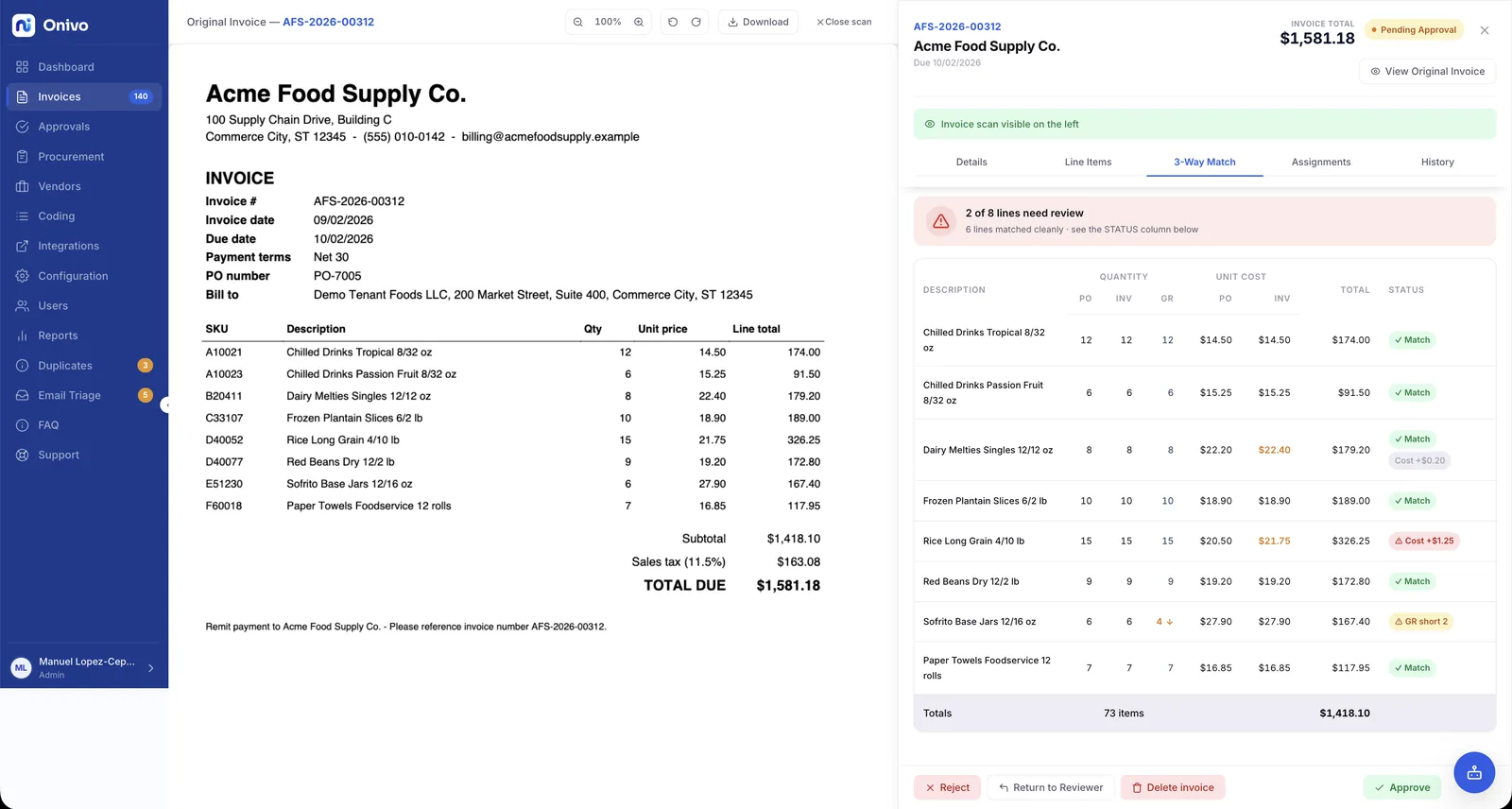 Three-way match comparing each invoice line with the purchase order and goods receipt: quantities from all three, unit costs, and a per-line status of match, cost variance, or short receipt